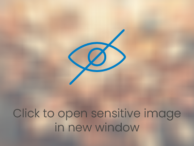 Sensitive image